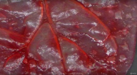 В листьях шпината вырастили клетки сердечной мышцы человека