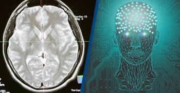 Учёные впервые в истории подключили человеческий мозг к компьютеру по беспроводной сети